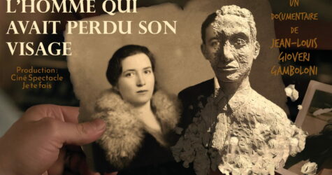 Documentaire: L&rsquo;homme qui avait perdu son visage